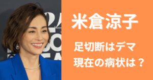 米倉涼子が足切断のデマが流れた理由は?現在の病状が関係してる?